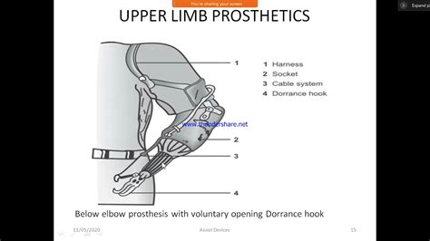 ORTHOSIS & PROSTHESIS - YouTube