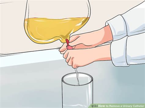 3 Ways to Remove a Urinary Catheter - wikiHow