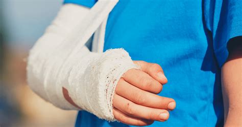 Learn more about the recovery timeline from hand surgery.