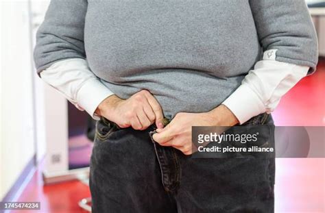 120 Morbid Obesity Stock Photos, High-Res Pictures, and Images - Getty ...