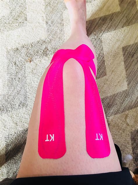 KT Tape for knee support : r/ehlersdanlos