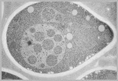 Yoshinori Ohsumi - Elucidating the mechanism of autophagy | Research ...