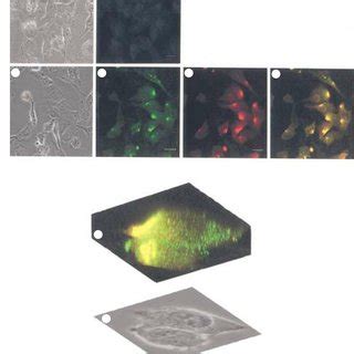 Expression of known components of the plasminogen activation cascade on... | Download Scientific ...