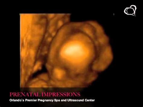 16 weeks 3D Ultrasound 4D Ultrasound - YouTube