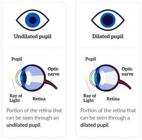 Dilated Eye Exam - El Paso Optical Center