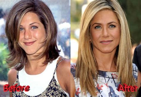 12 Celebrity Nose Jobs You Didn't Know About