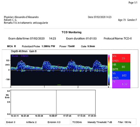 Normal image of TCD-X registration | Download Scientific Diagram