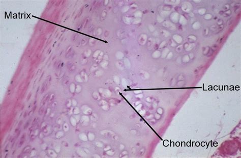 4 Human hyaline cartilage (Haematoxylin & Eosin stain) | Download Scientific Diagram