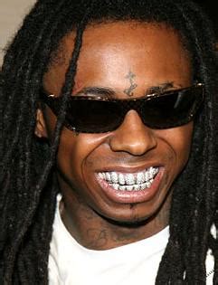 Lil Wayne Teeth Before Grill : Lil Wayne Undergoes Emergerncy Dental ...