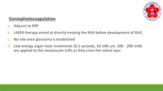 neovascular glaucoma | PPT