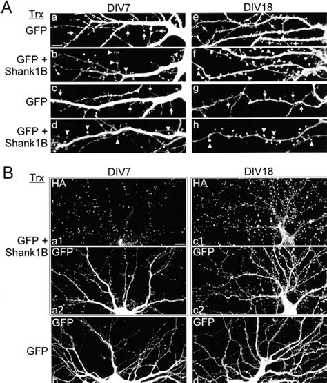 Regulation of Dendritic Spine Morphology and Synaptic Function by Shank ...