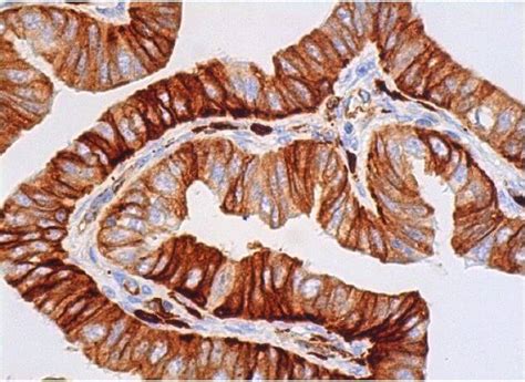 Anti-HLA-DR Antibody (520B) | SCBT - Santa Cruz Biotechnology