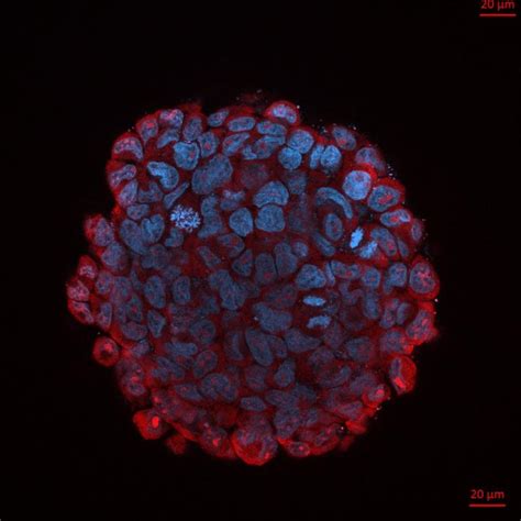 New molecule reduces the aggressiveness of pe | EurekAlert!