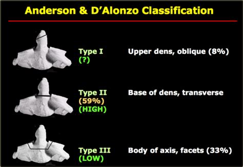 Dens fracture types - Clinical Guide Wiki