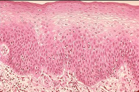 Stratified Squamous Epithelium Slide 400x