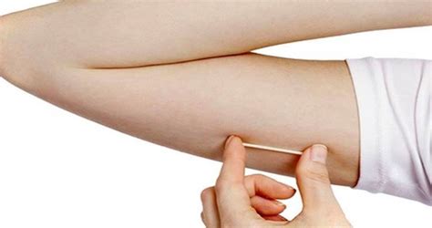 Nexplanon: The Birth Control Implanted In My Arm – | Baby Gizmo