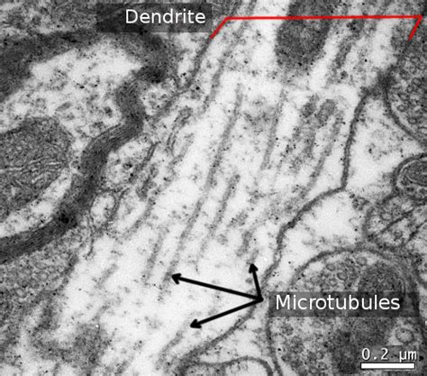 Cytoskeleton - the muscle and the bone of a cell - definition ...