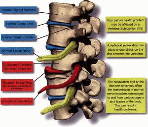 What is a Subluxation? – Tri State Clinic North Chiropractic of Chattanooga