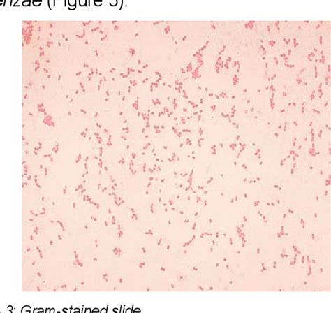 Figure 3 from Pasteurella Canis аs а Cause оf Soft-Tissue Infection after Dog Bite: a Case ...