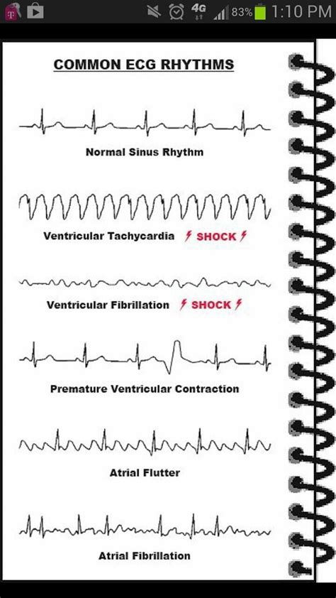 Ekg Worksheets For Students - Worksheet Template Student Layla