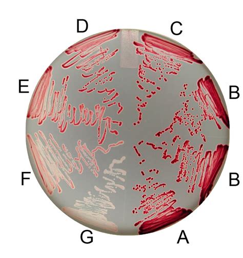 Multiple silent mutations greatly impact protein translation, study finds