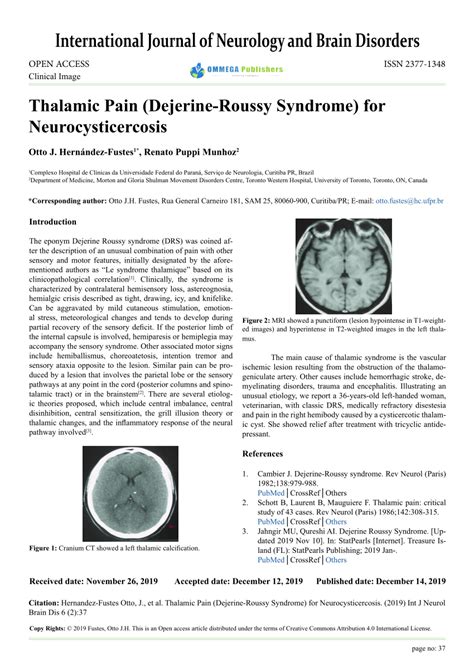 (PDF) Thalamic pain (Dejerine-Roussy) for Neurocysticercosis