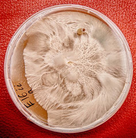 Viewing mycelium on microscope slide. - Mushroom Cultivation - Shroomery Message Board