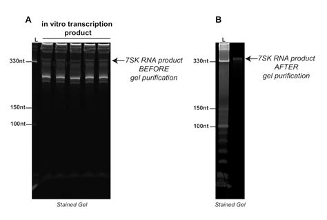 Antibody-Free Assay for RNA Methyltransferase Activity Analysis