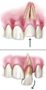 Tooth Pain After Injury