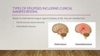 Pathophysiology and management of epilepsy | PPT