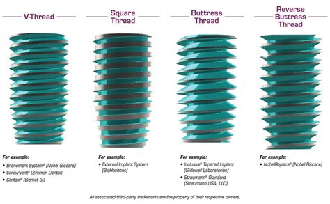 im0104-rd-implant-thread-02