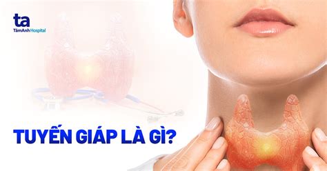 Tuyến giáp là gì? Vị trí nằm ở đâu? Cấu tạo như thế nào?