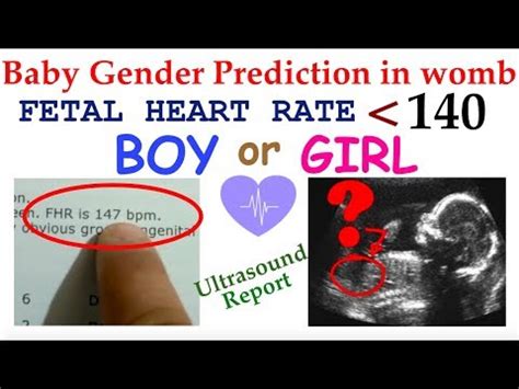 Baby Heartbeat At 11 Weeks Boy Or Girl – Baby tickers