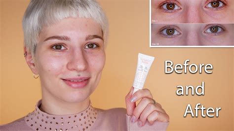 Avene Soothing Eye Contour Cream | Before & After - YouTube