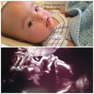 1 Year Anniversary of Down Syndrome Ultrasound - News Anchor to ...