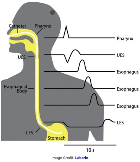 Oesophageal Manometry - MEDizzy