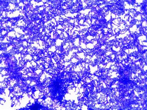 Bacillus Subtilis Gram Stain Positive Or Negative