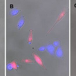 Microscopic examination of a mixed culture between a human hybrid cell... | Download Scientific ...