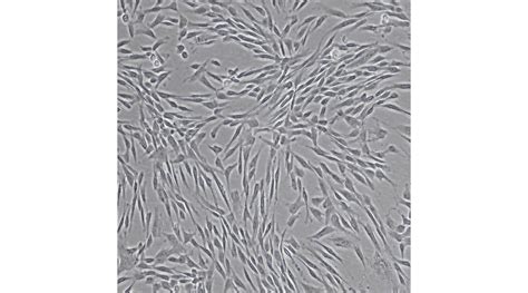 Human Wharton's jelly (Umbilical Cord-Derived) mesenchymal stem cells ...