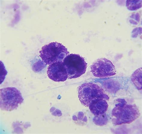 File:Mast cell tumor cytology 2.JPG - Wikipedia, the free encyclopedia