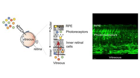 Novel gene therapy platform speeds search for ways to cure blindness ...