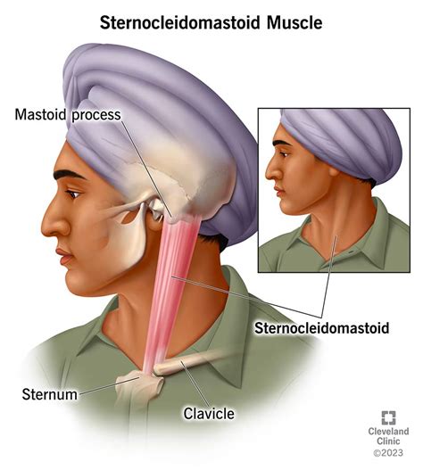 What Is the Sternocleidomastoid (SCM Muscle)?