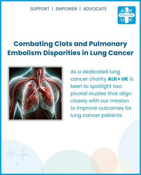 ALK+ UK: Two pivotal studies on oral anticoagulants for lung cancer ...