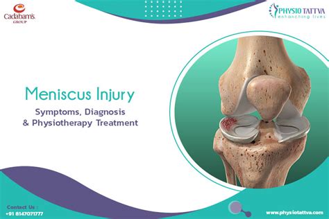 All You Need to Know About Meniscus Injury (Torn Meniscus)