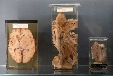 Vienna exhibition tests ethics of displaying human remains
