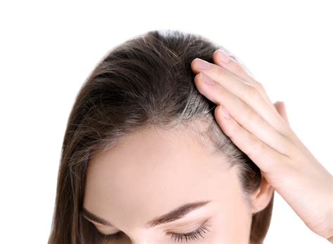 Female Hair Loss at The Temples: Causes and Treatment - Blog | Keranique