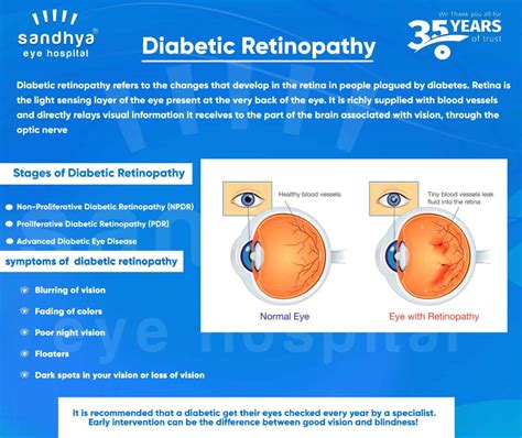 Diabetic Retinopathy - Sandhya Eye Hospitals