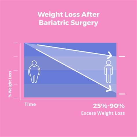 7 Types of Weight Loss Surgery - How Each Will Affect You - Bariatric Surgery Source