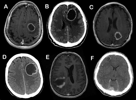 Radiology Signs | Radiology, Radiology imaging, Medical imaging