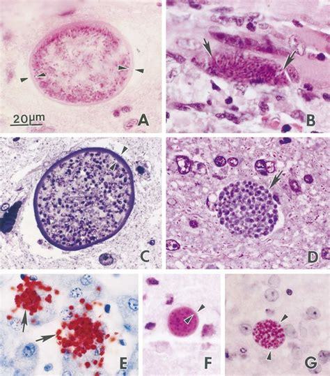 Neospora caninum (A–F) tachyzoites and tissue cysts in histologic... | Download Scientific Diagram